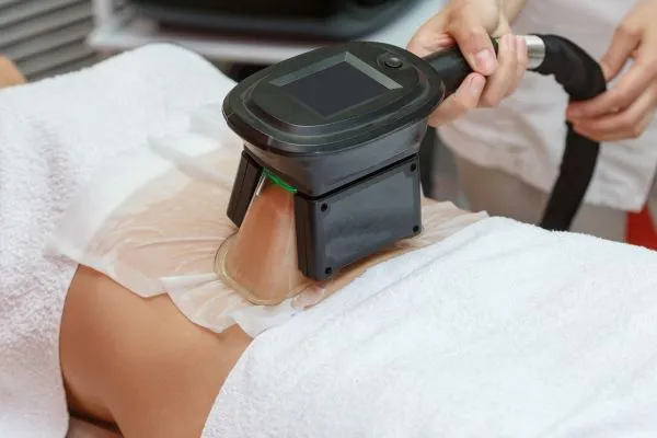 Image of person having fat freezing treatment to help weight gain Belper