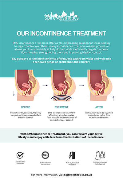 image of how urge incontinence Belper treatment works