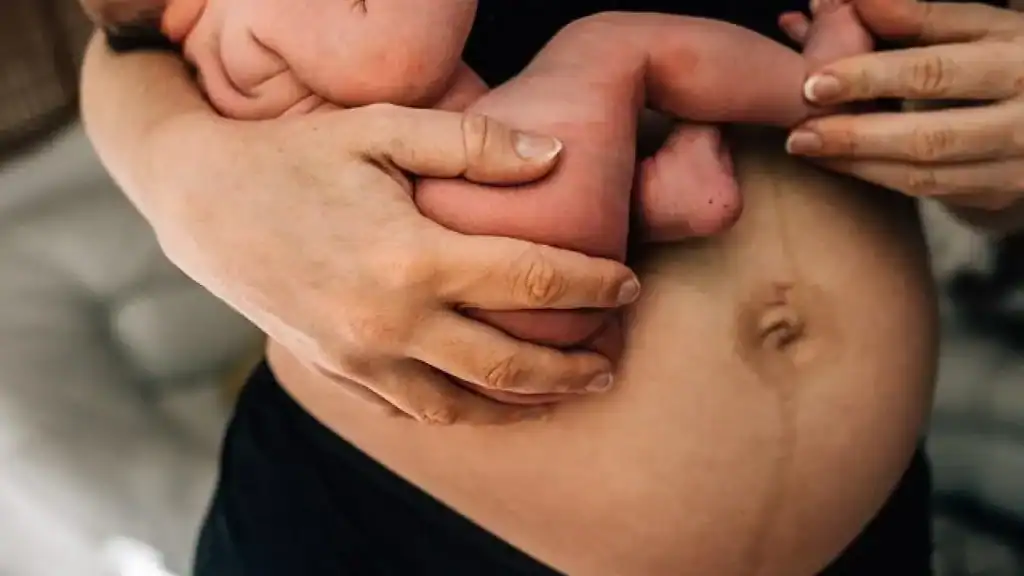 Why Is My Stomach Still Big After Pregnancy Belper?